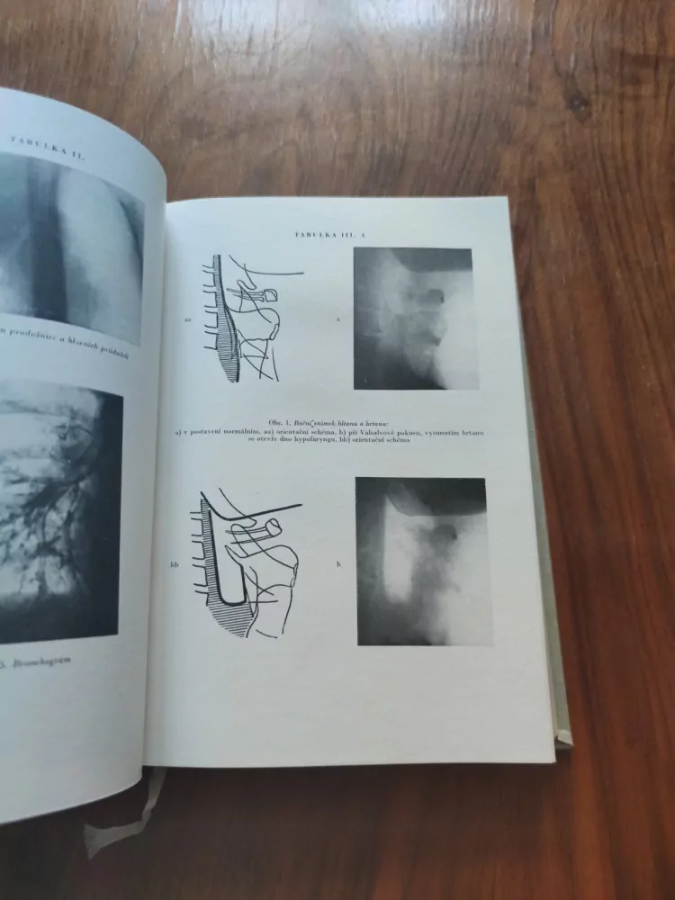 ANTONÍN PŘECECHTĚL, ROBERT HLADKÝ, FRANTIŠEK KOTYZA, KAREL SEDLÁČEK - Základy otolaryngologie